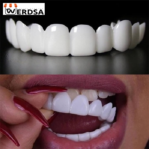 قیمت snap on smile