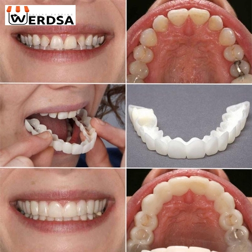 سایت فروش  لمینت متحرک دندان دو فک snap on smile